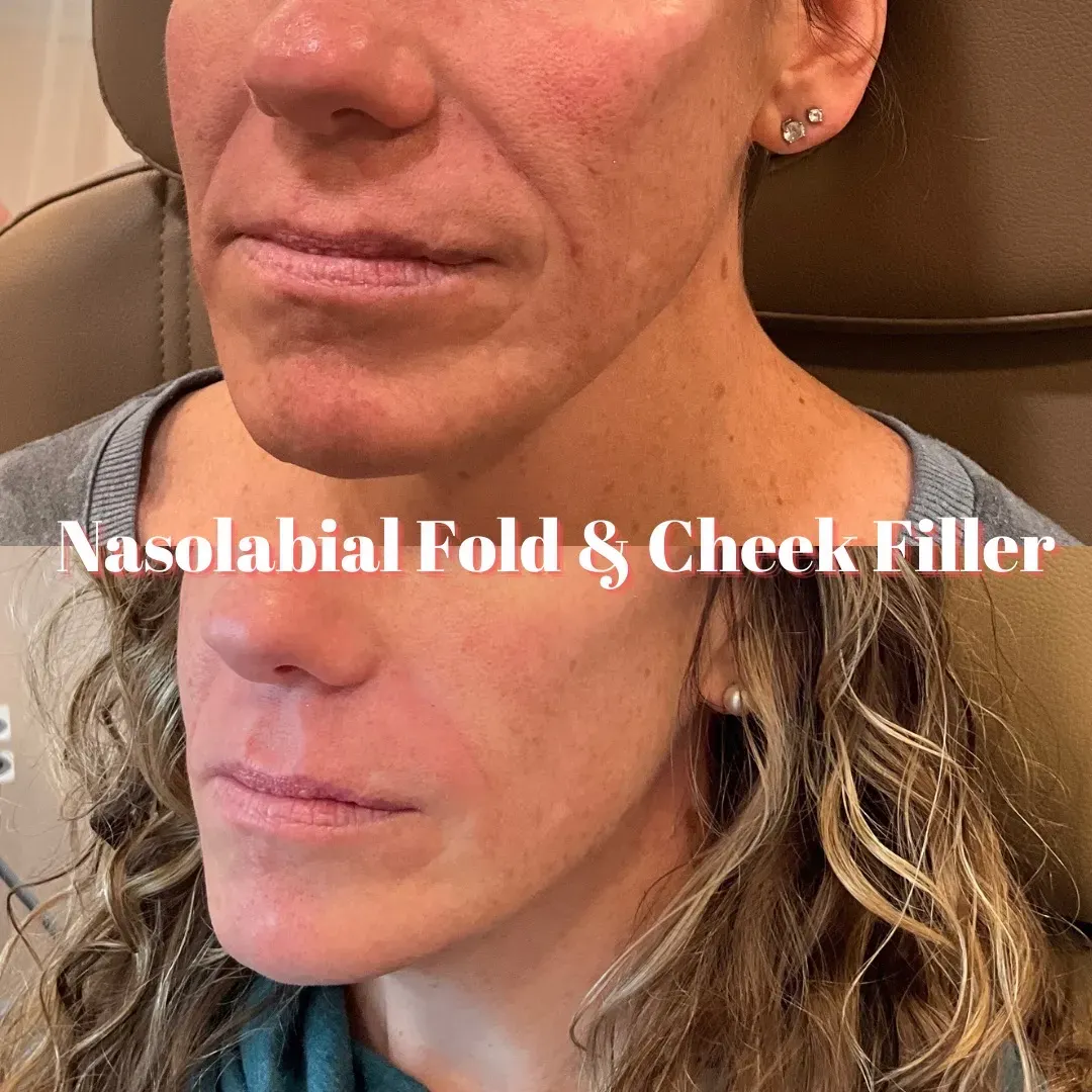 Facetune_17-11-2023-12-09-03_min