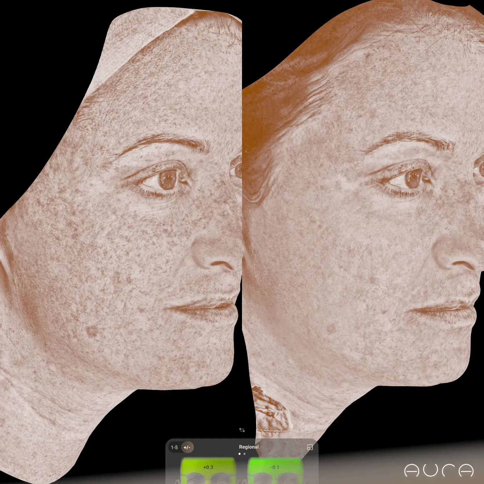 Skin Resurfacing Richmond VA