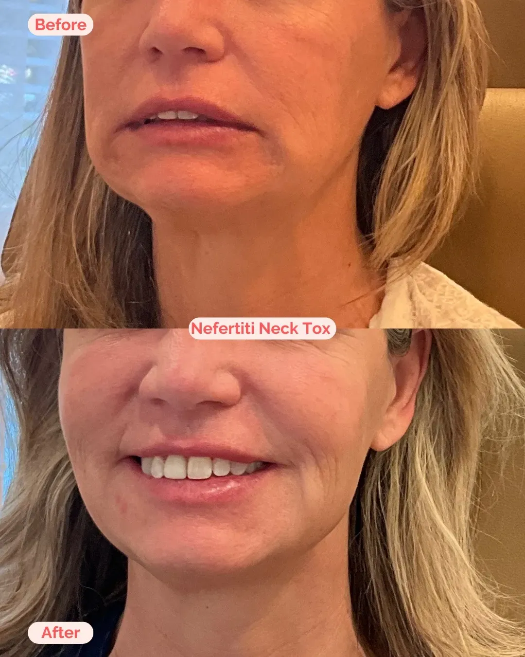 Insta B&A- New Size 20242025.zip - 7 (2)_min