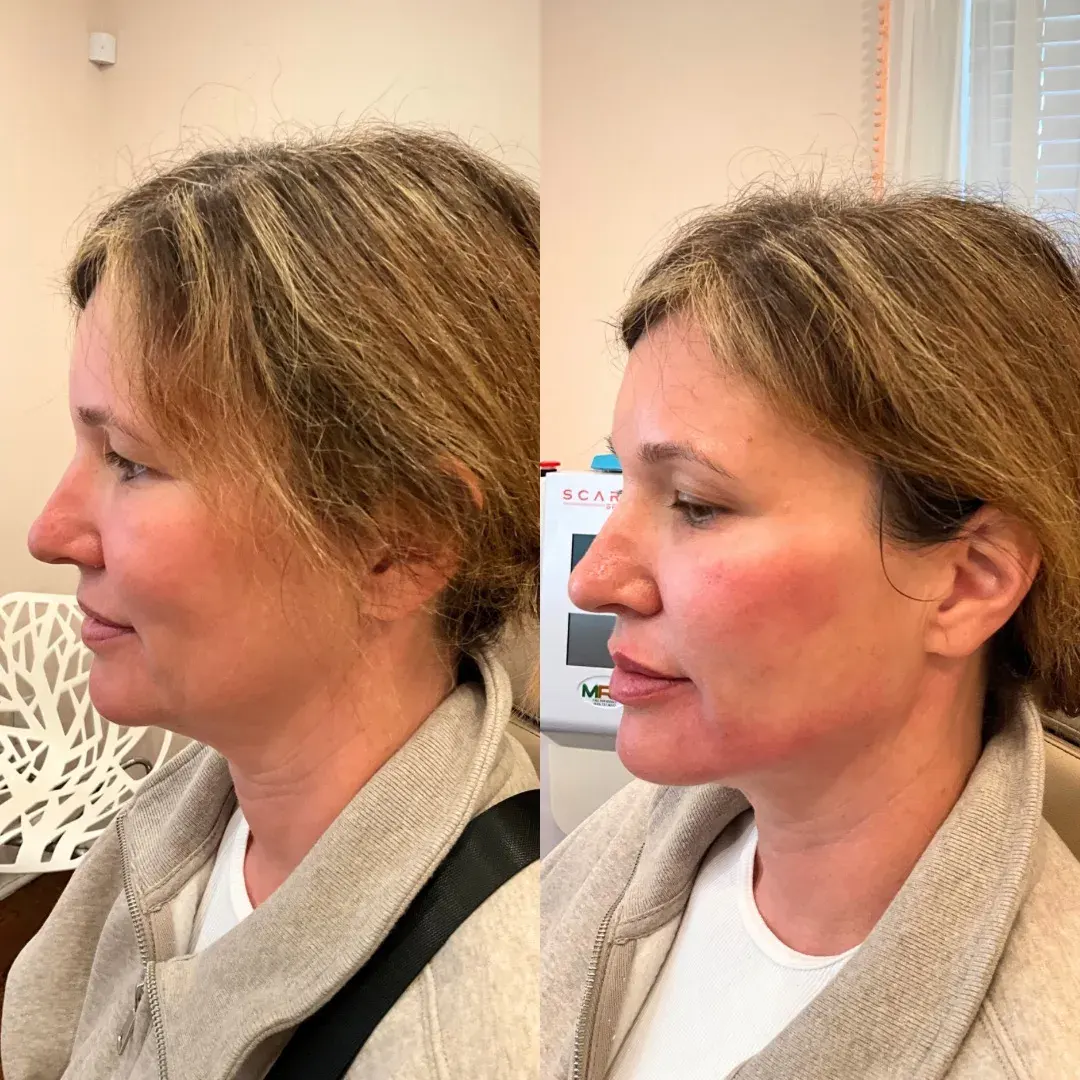 Julia B&A 2024 11 - 28_min