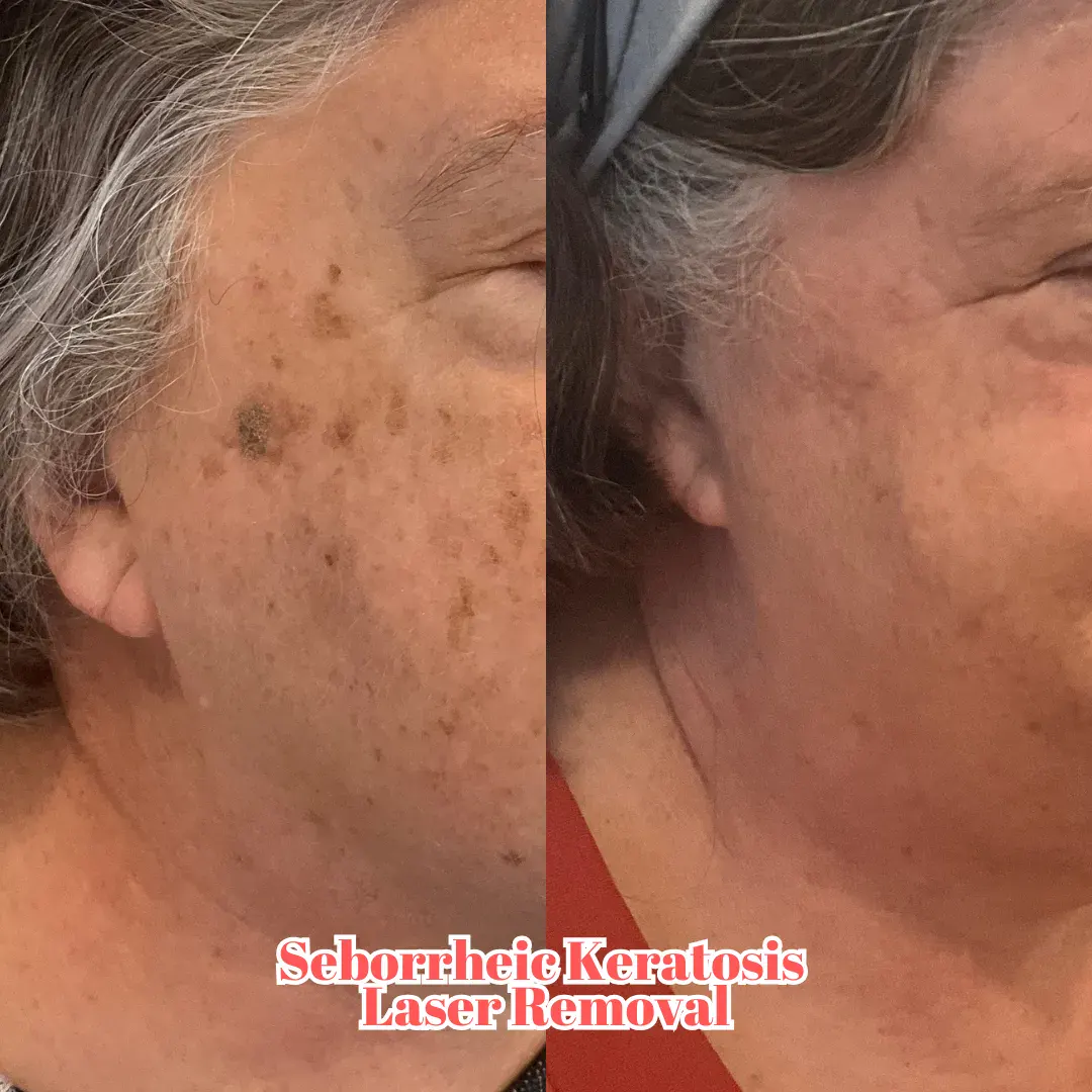 Julia B&A 2024 11 (2)_min