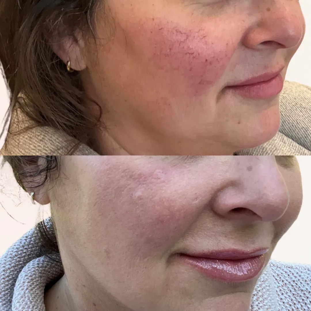 Julia B&A 2024 11 (3)_min