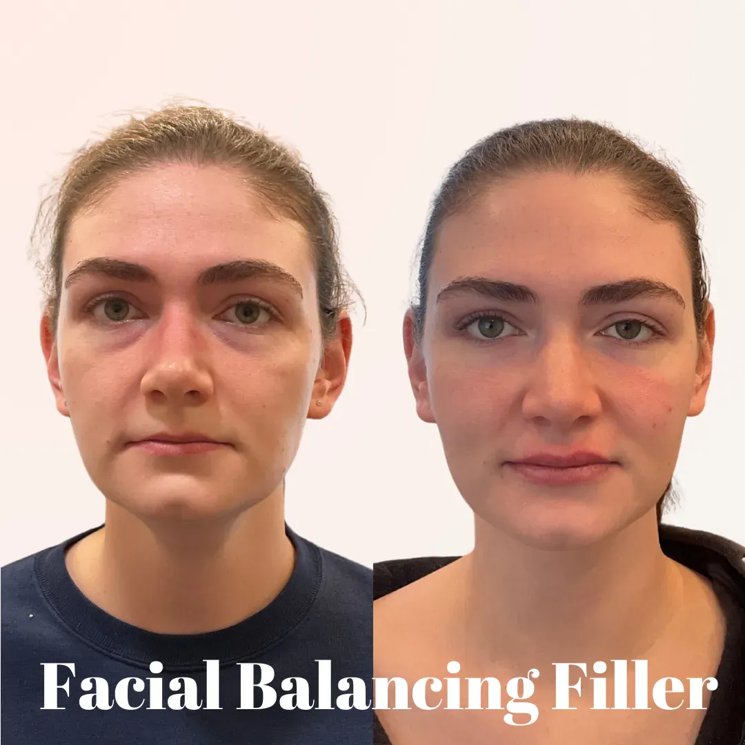 Julia B&A 2024 11 (4)_min