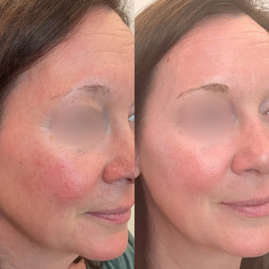 Julia B&A 2024 11_min