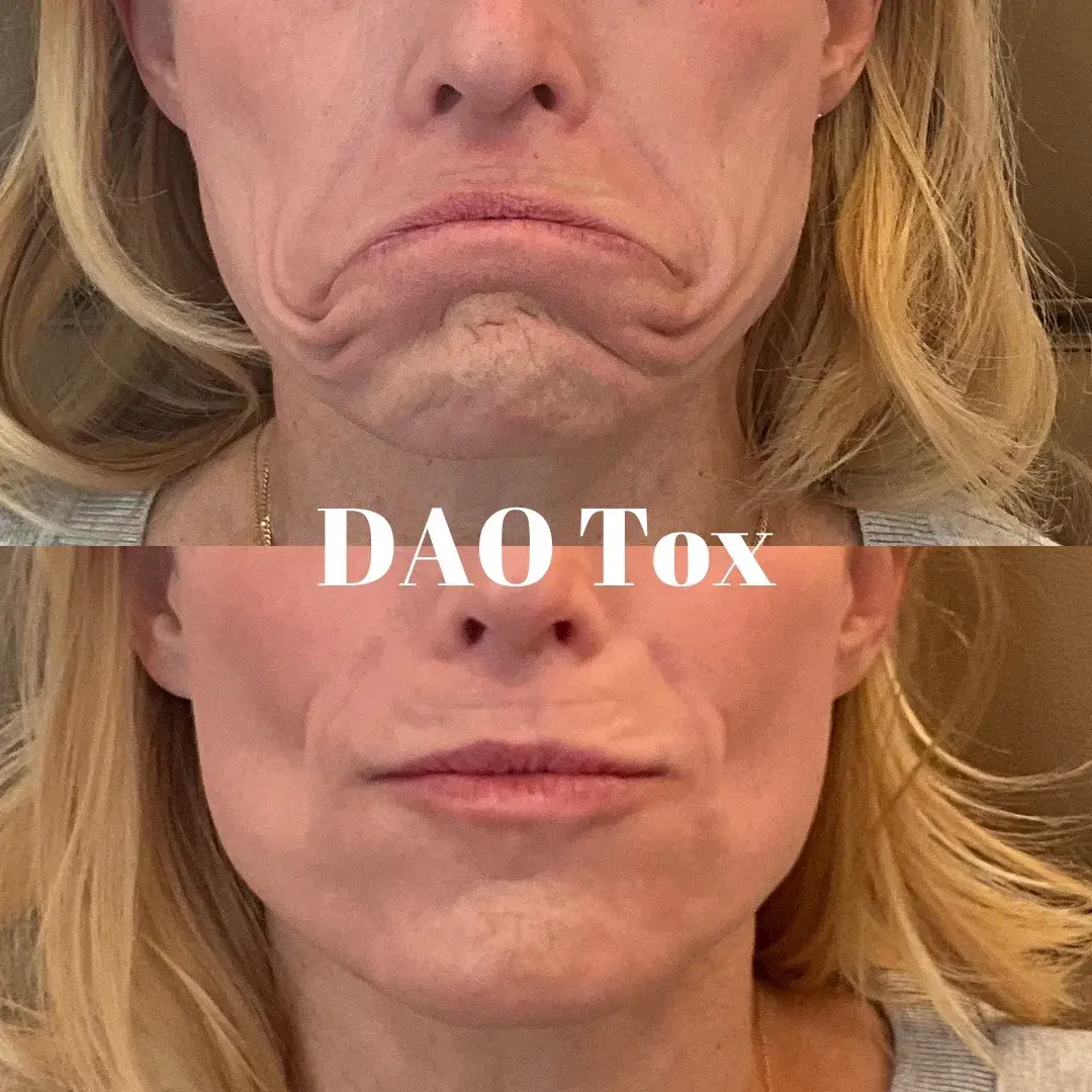 Julia B&A 2024 - 25_min