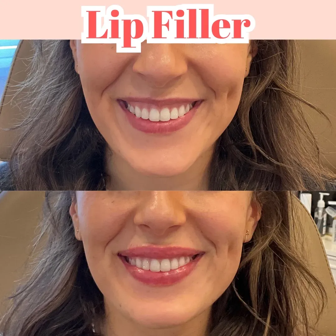 Julia B&A 2024 - 38_min