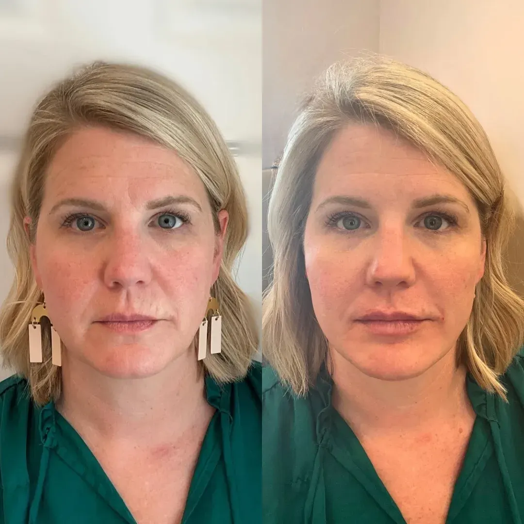 Julia B&A 2024 - 9_min