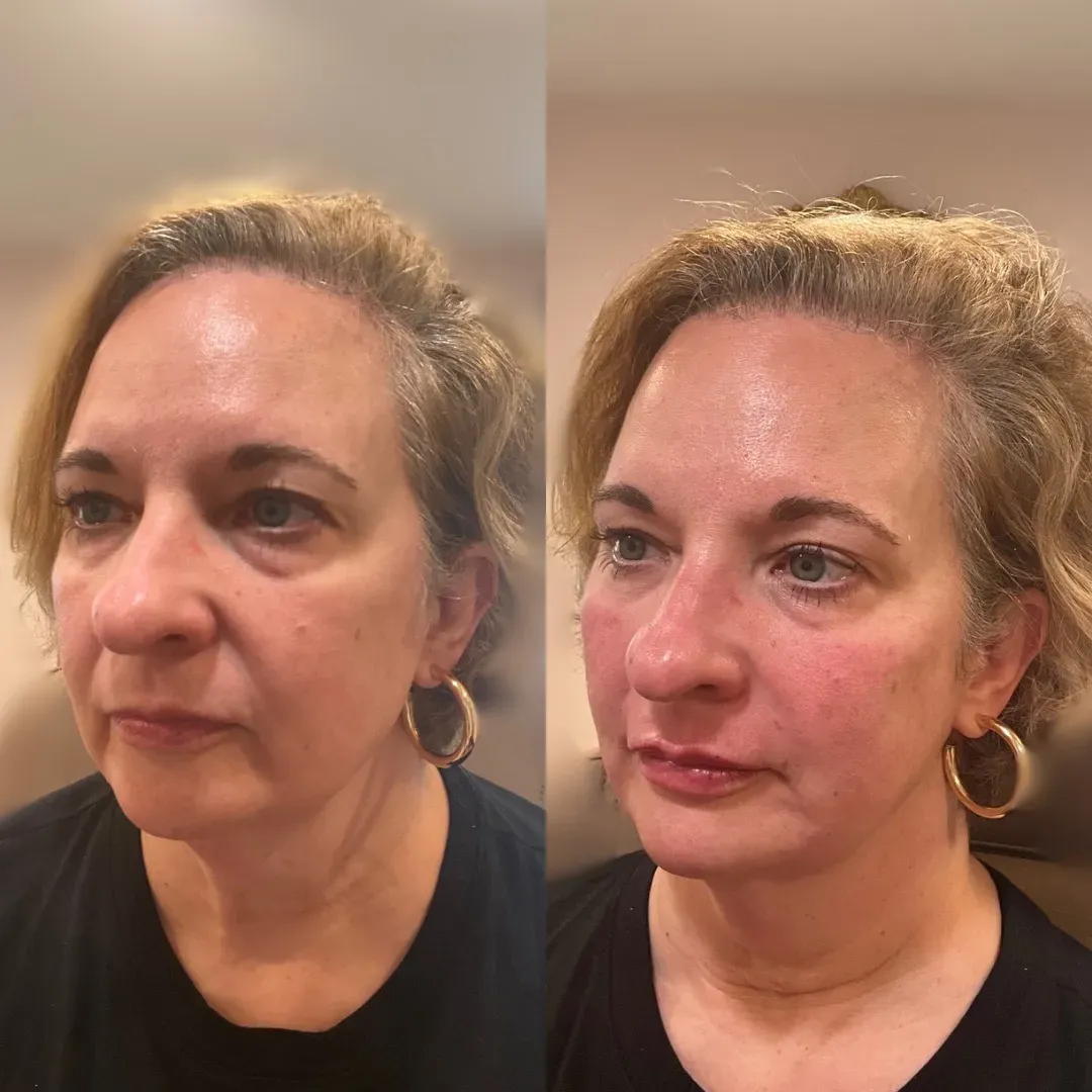 Julia B&A 2024(1)_min