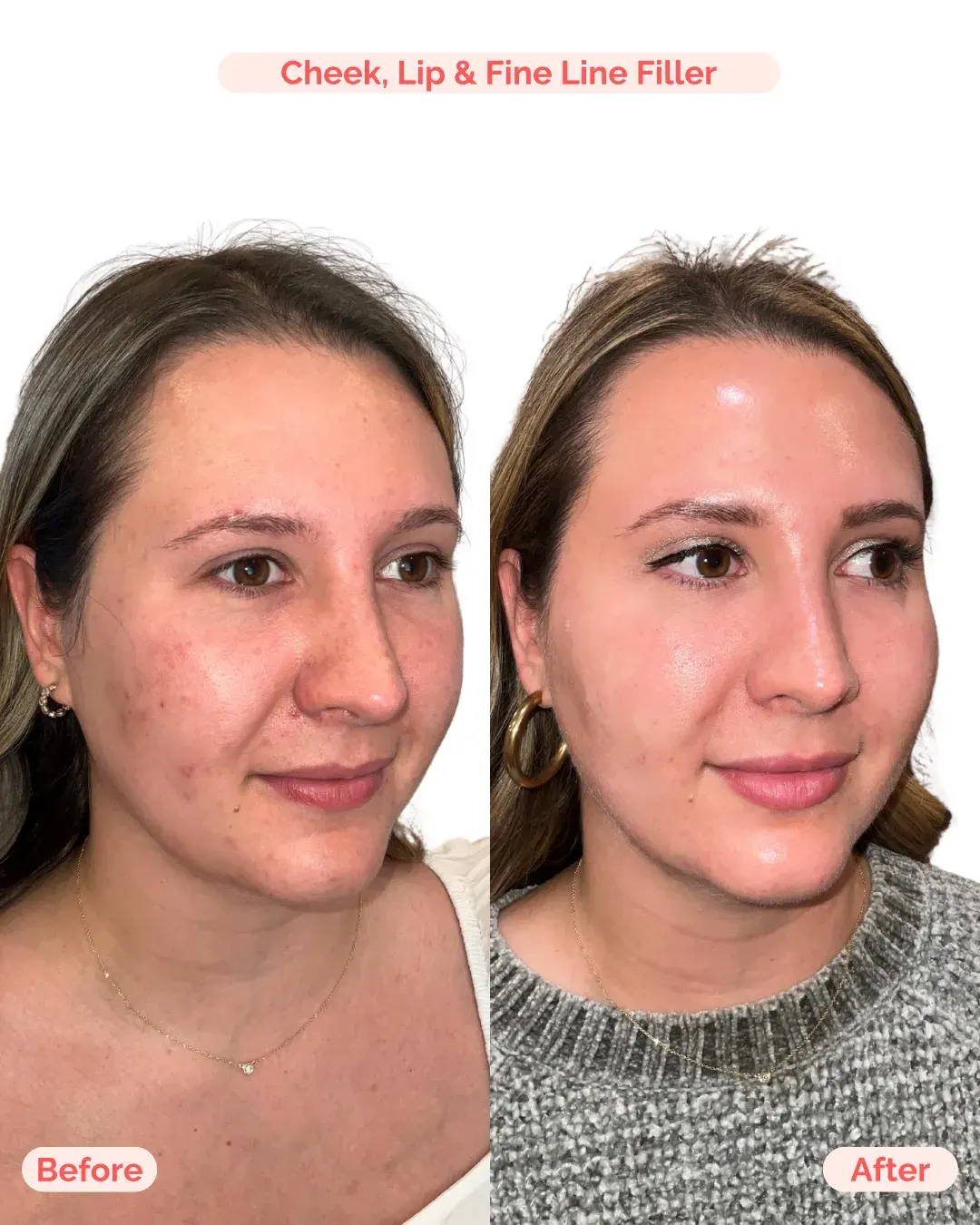 Julia B&A 2025 - 46_min