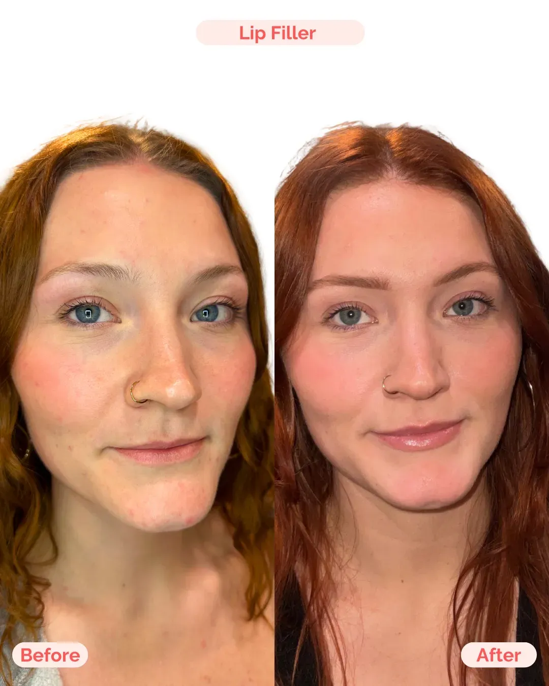 Julia B&A 2025 - 59_min