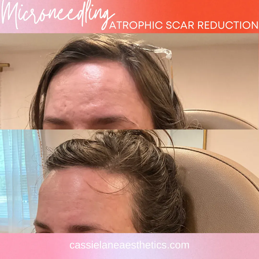 Julia_s CLA B&A #1 - 100_min