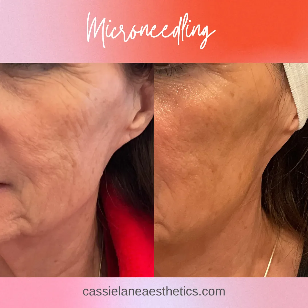 Julia_s CLA B&A #1 - 2_min