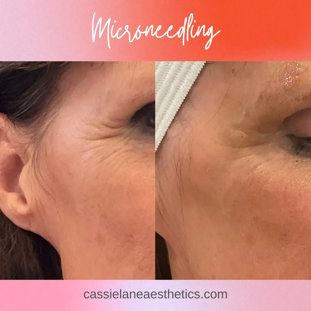 Julia_s CLA B&A #1 - 3_min