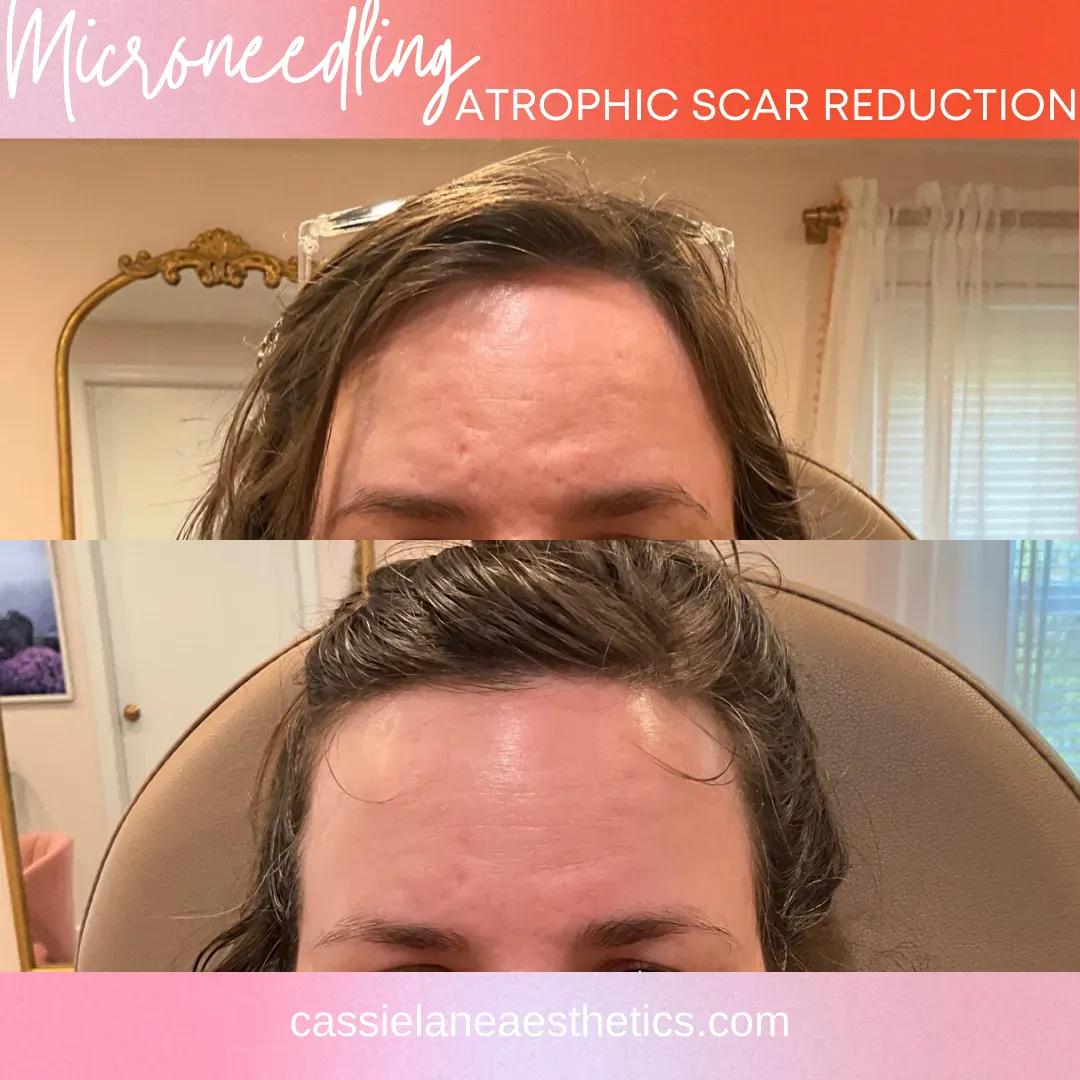 Julia_s CLA B&A #1 - 99_min