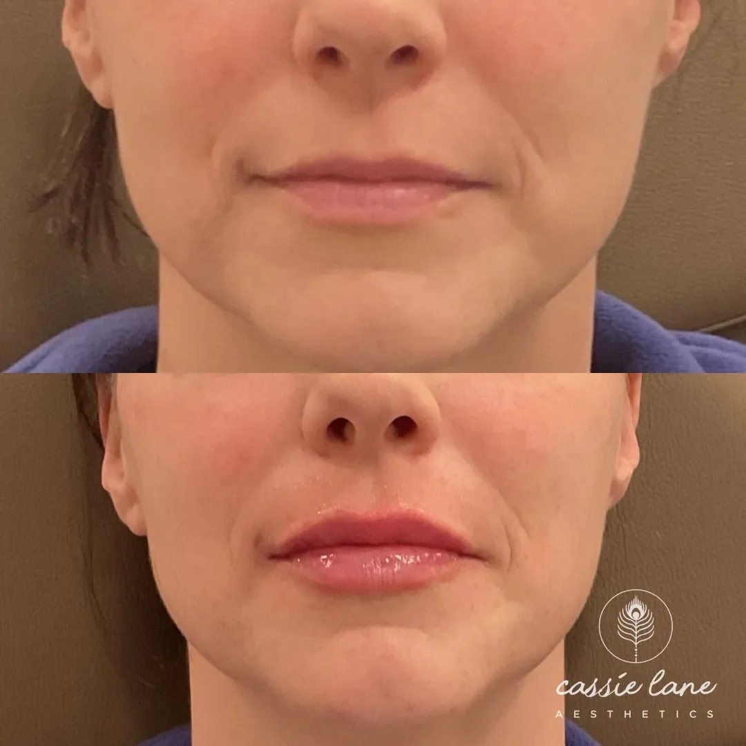 before and immediatley after_min