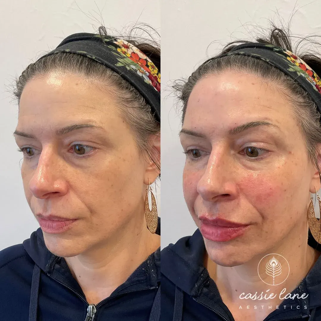 filler website (10)_min