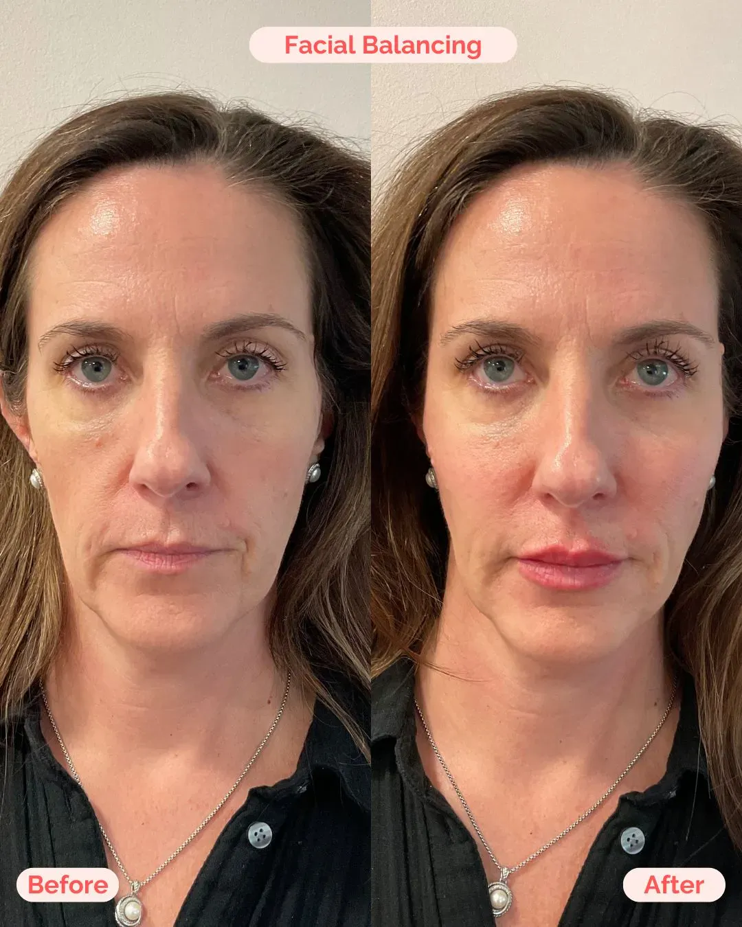 filler website (11)_min