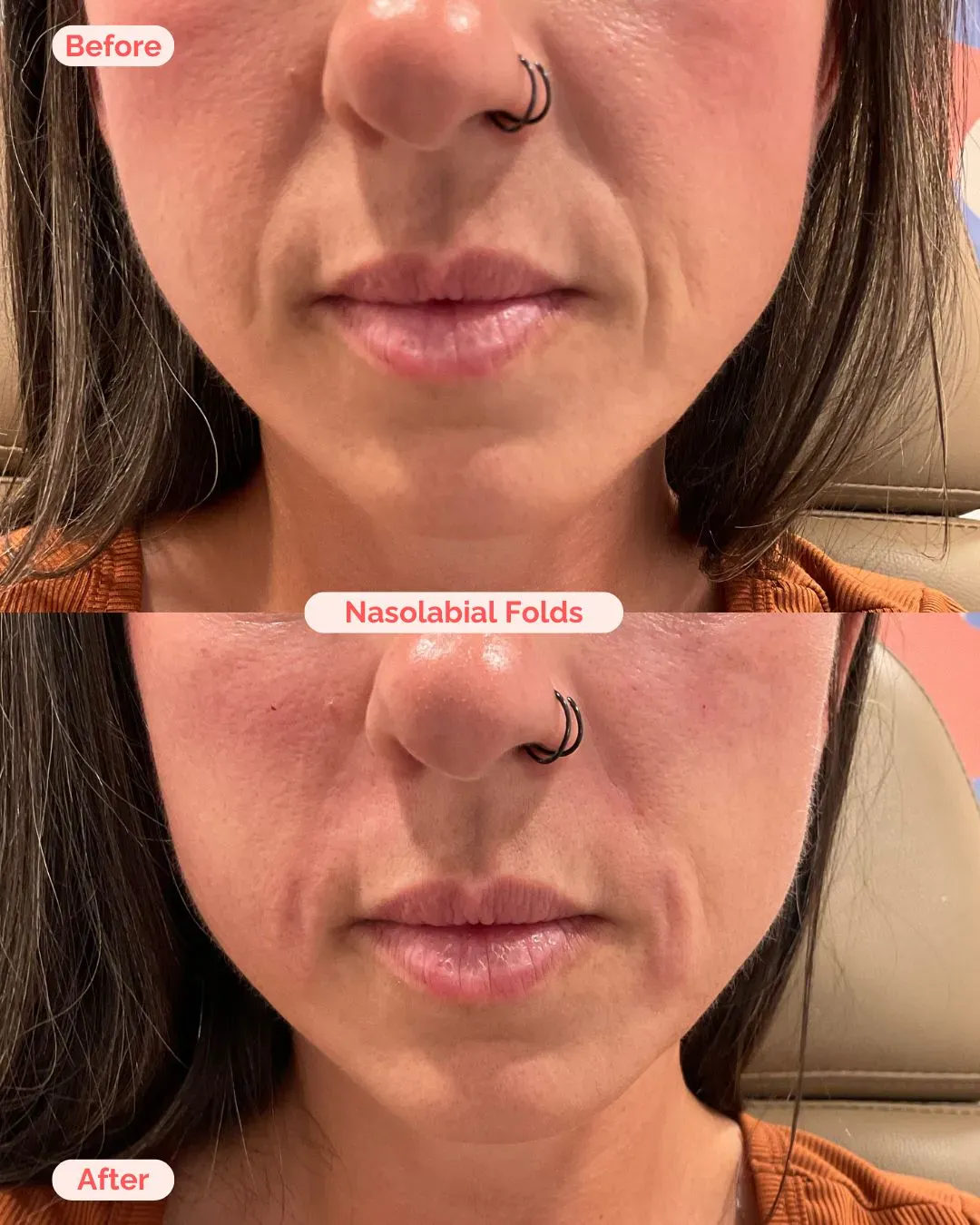 filler website (13)_min