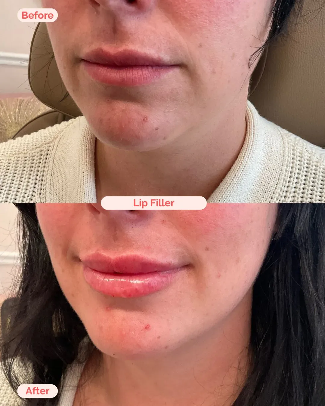 filler website (15)_min