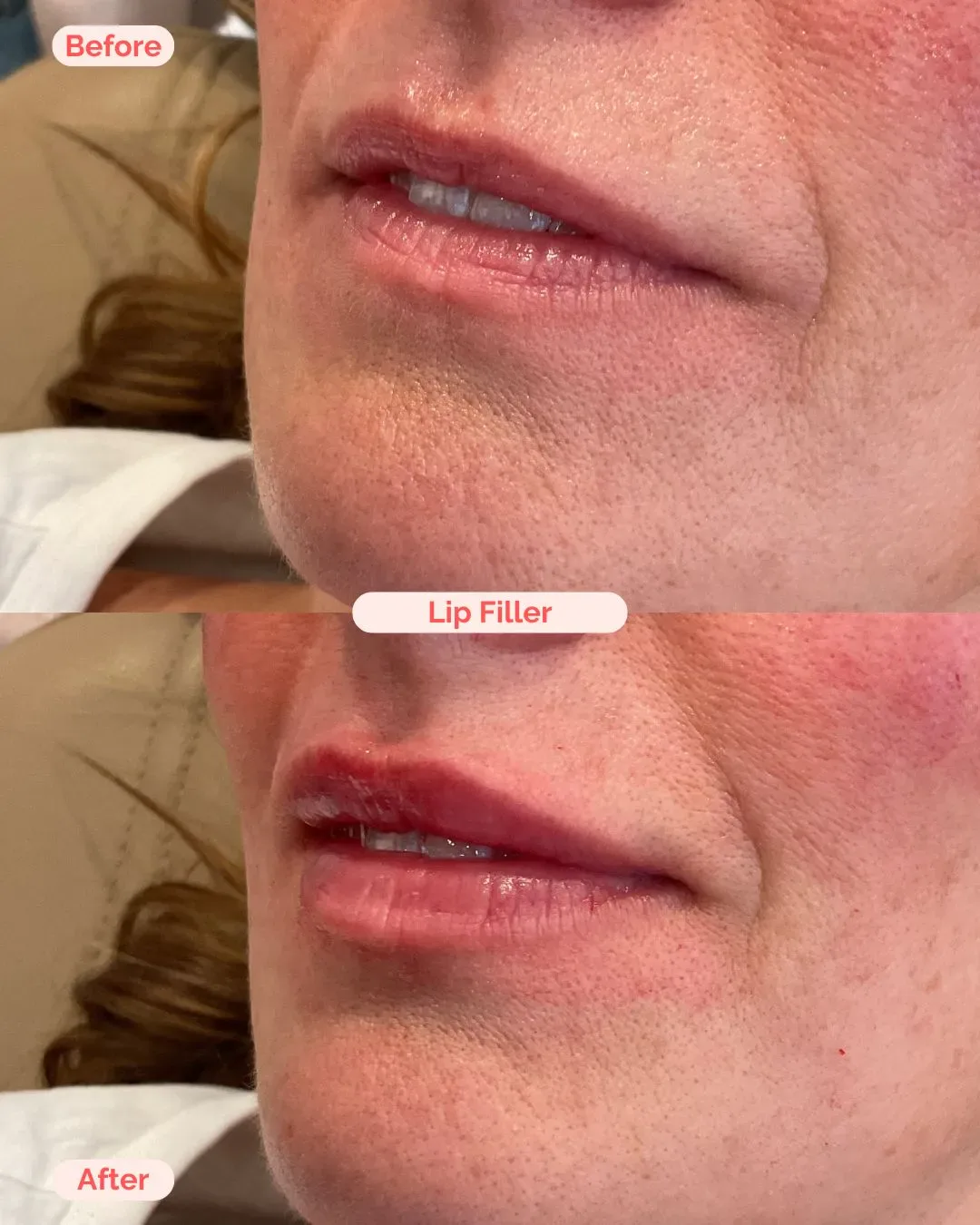 filler website (16)_min