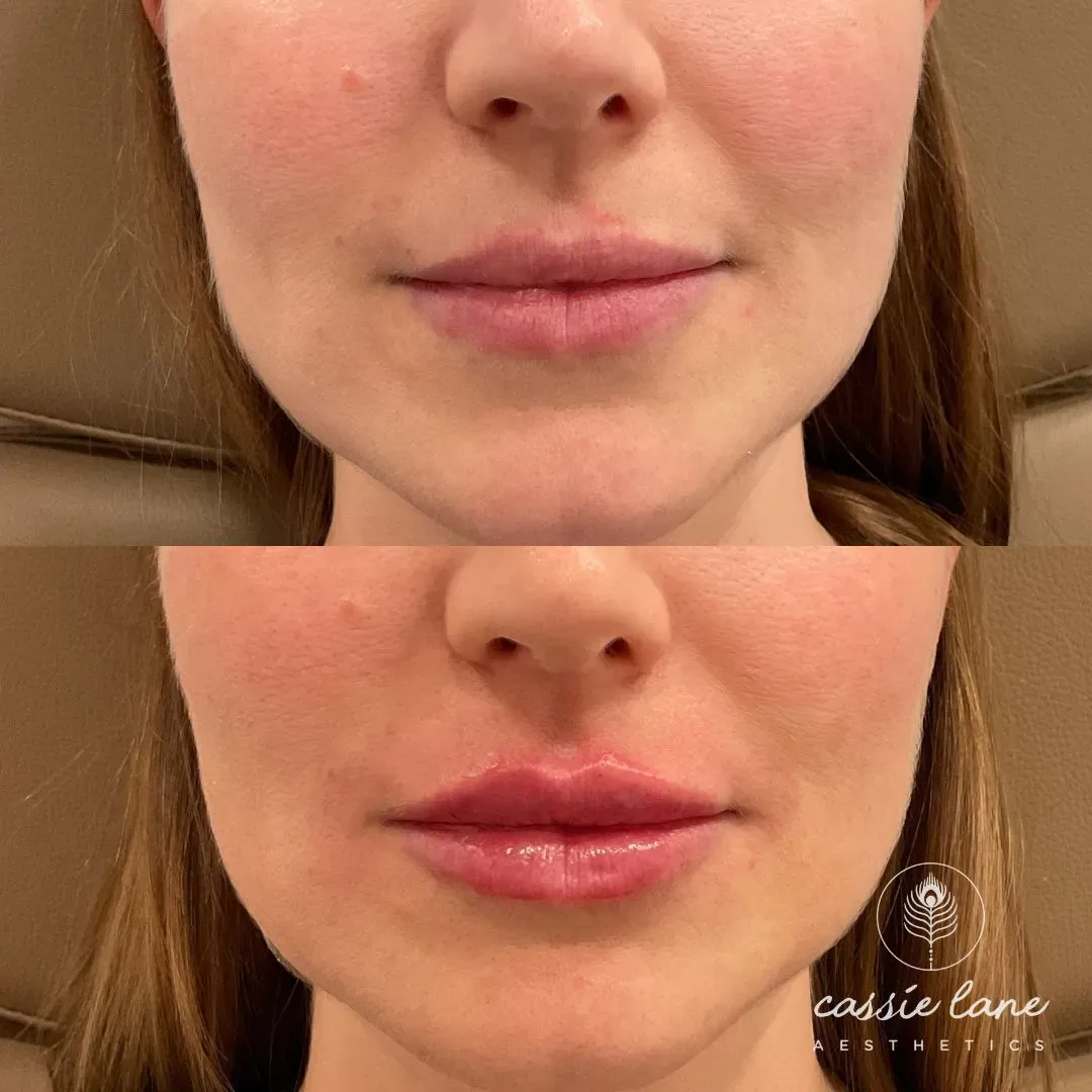 filler website (1)_min