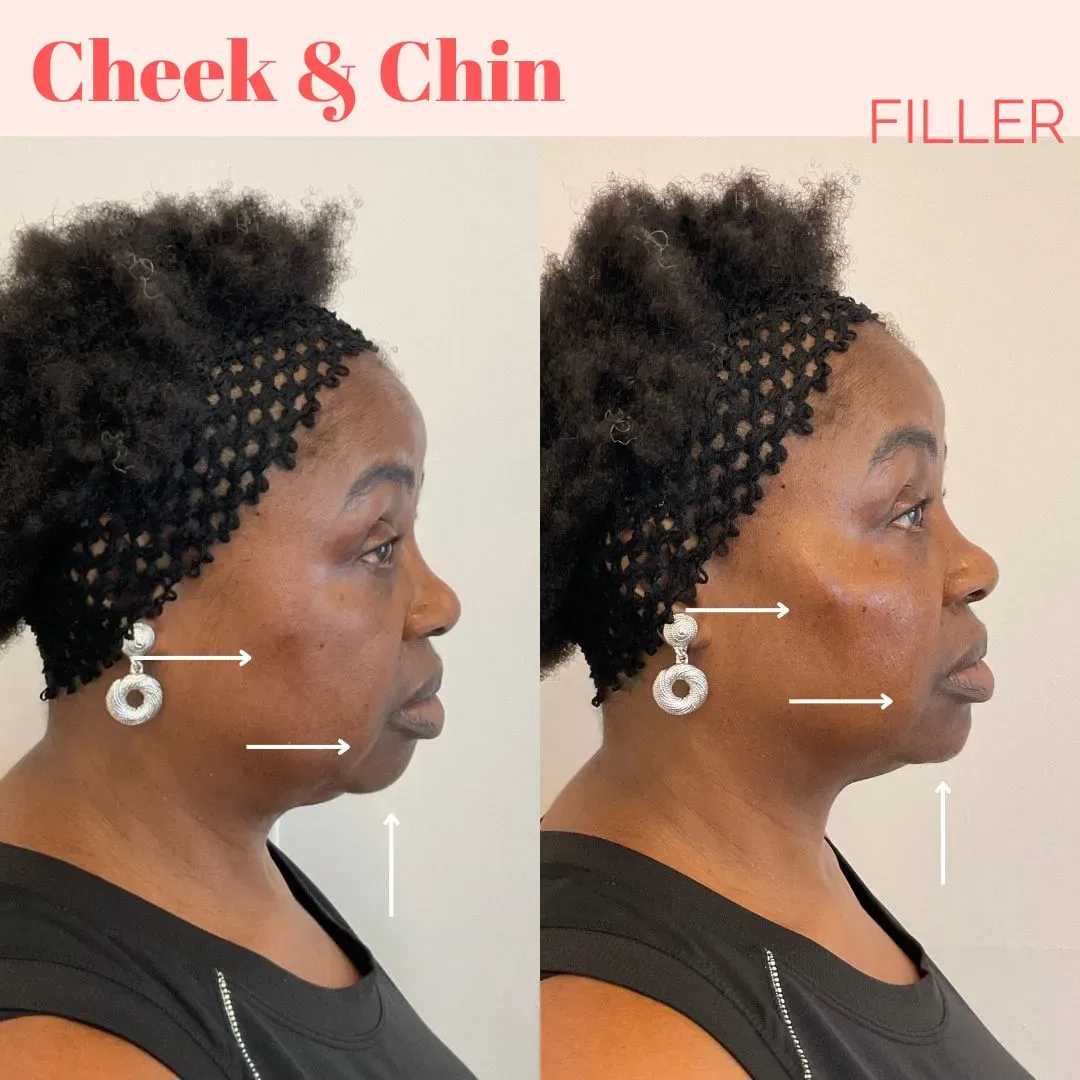 filler website (3)_min