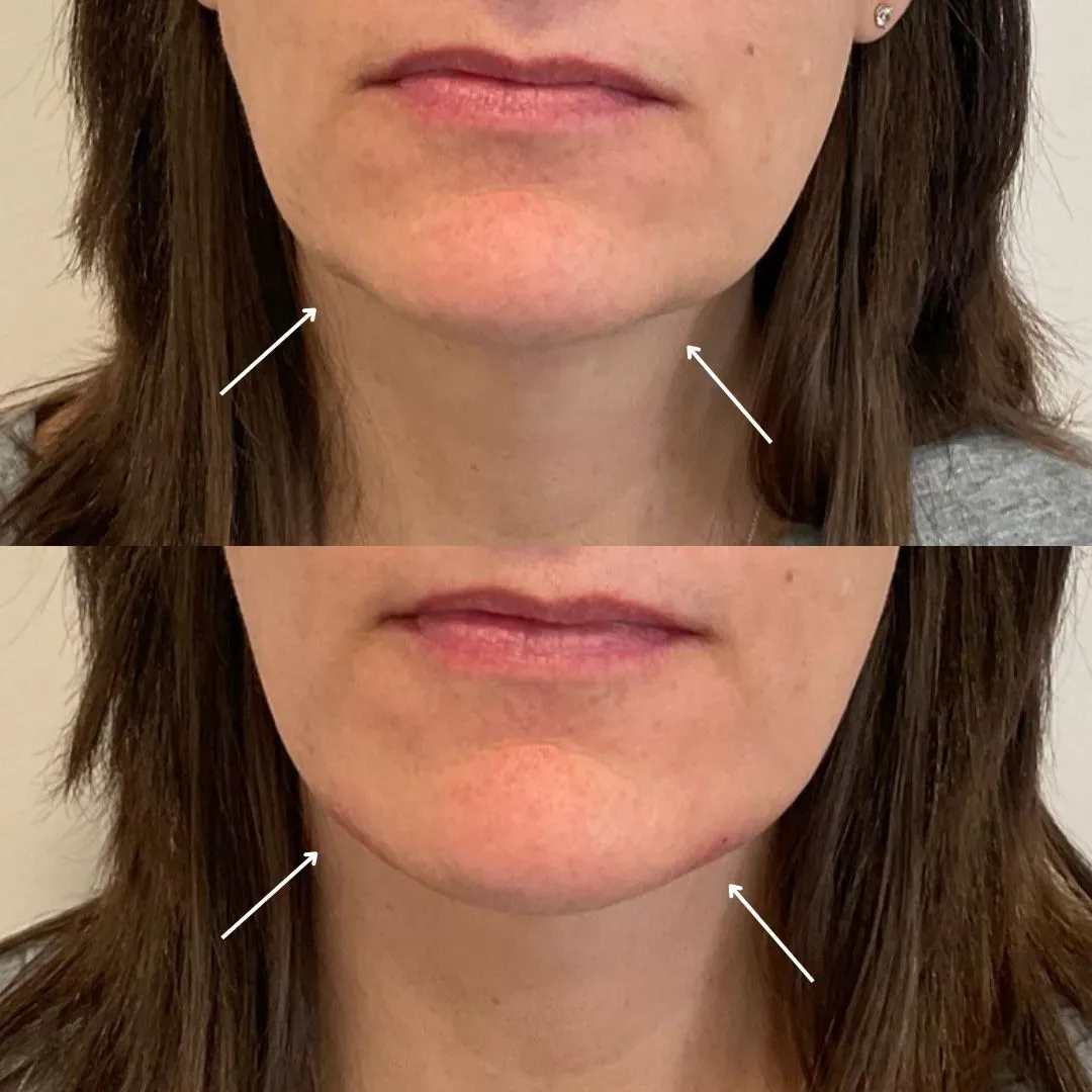 filler website (4)_min