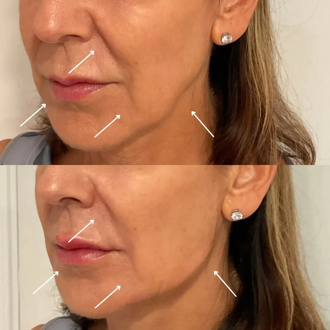 filler website (5)_min