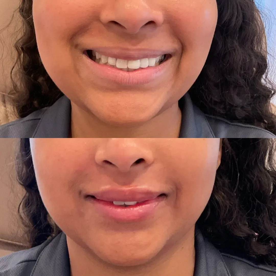 filler website (6)_min