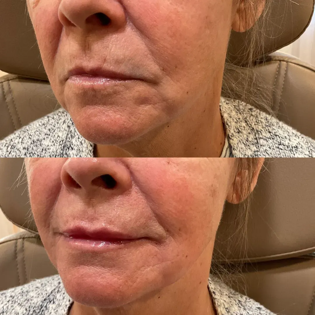 filler website (7)_min