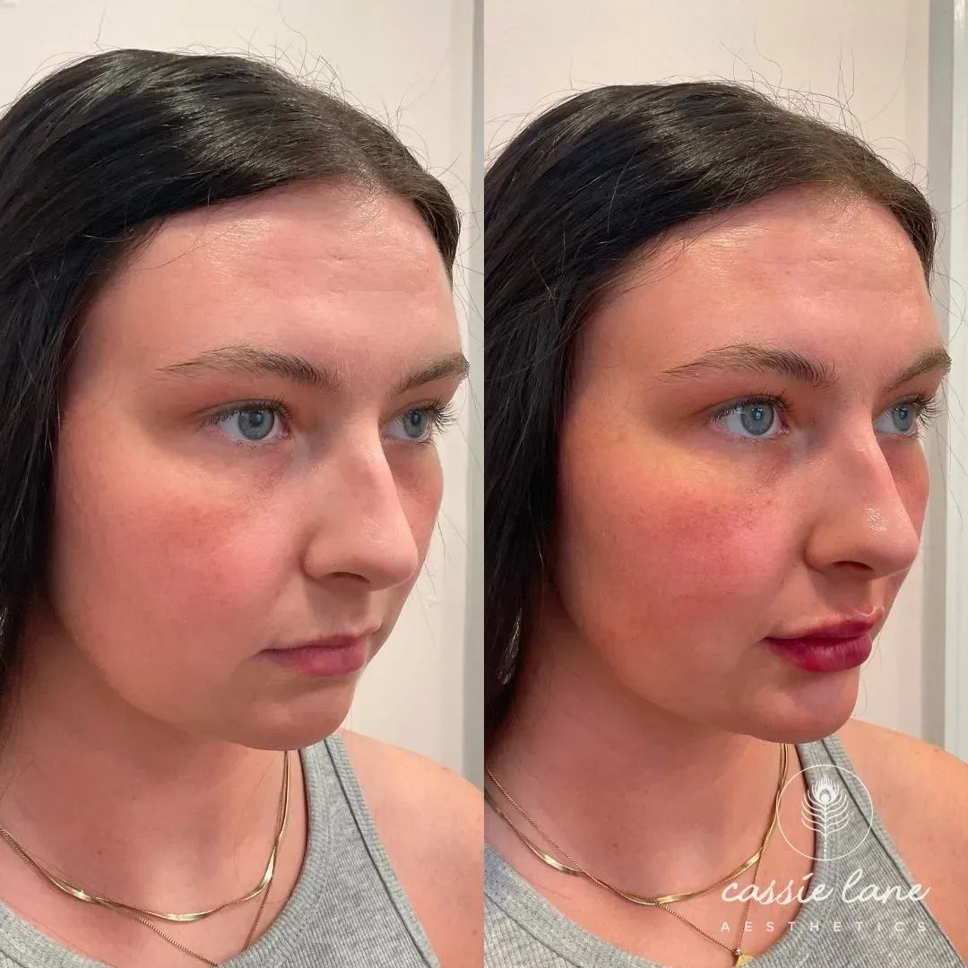 filler website (8)_min