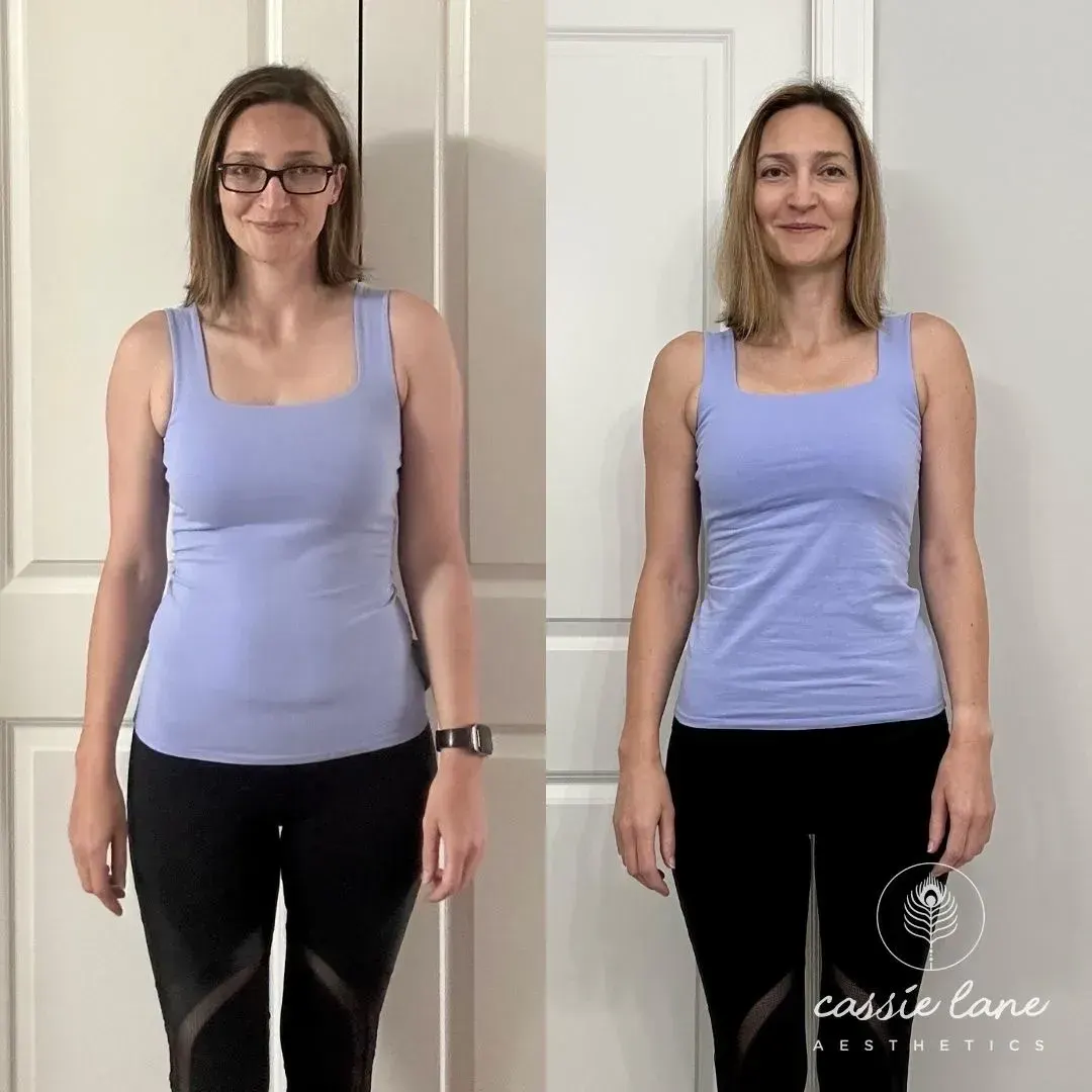 Medical Weight Loss Richmond VA