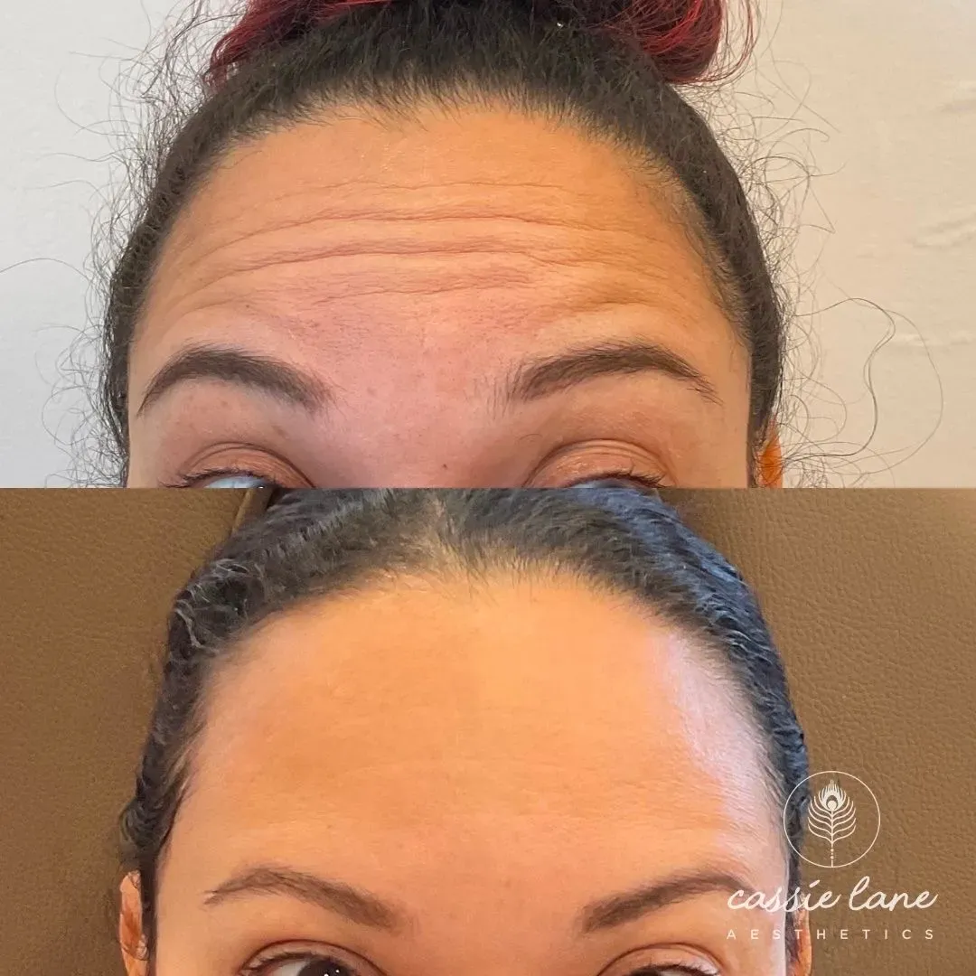 send-forhead tox_min