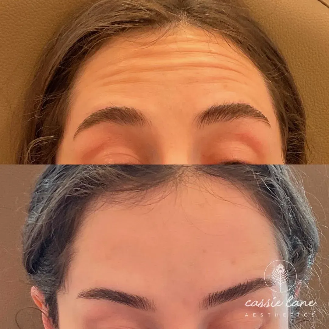 send-forhead with tox_min