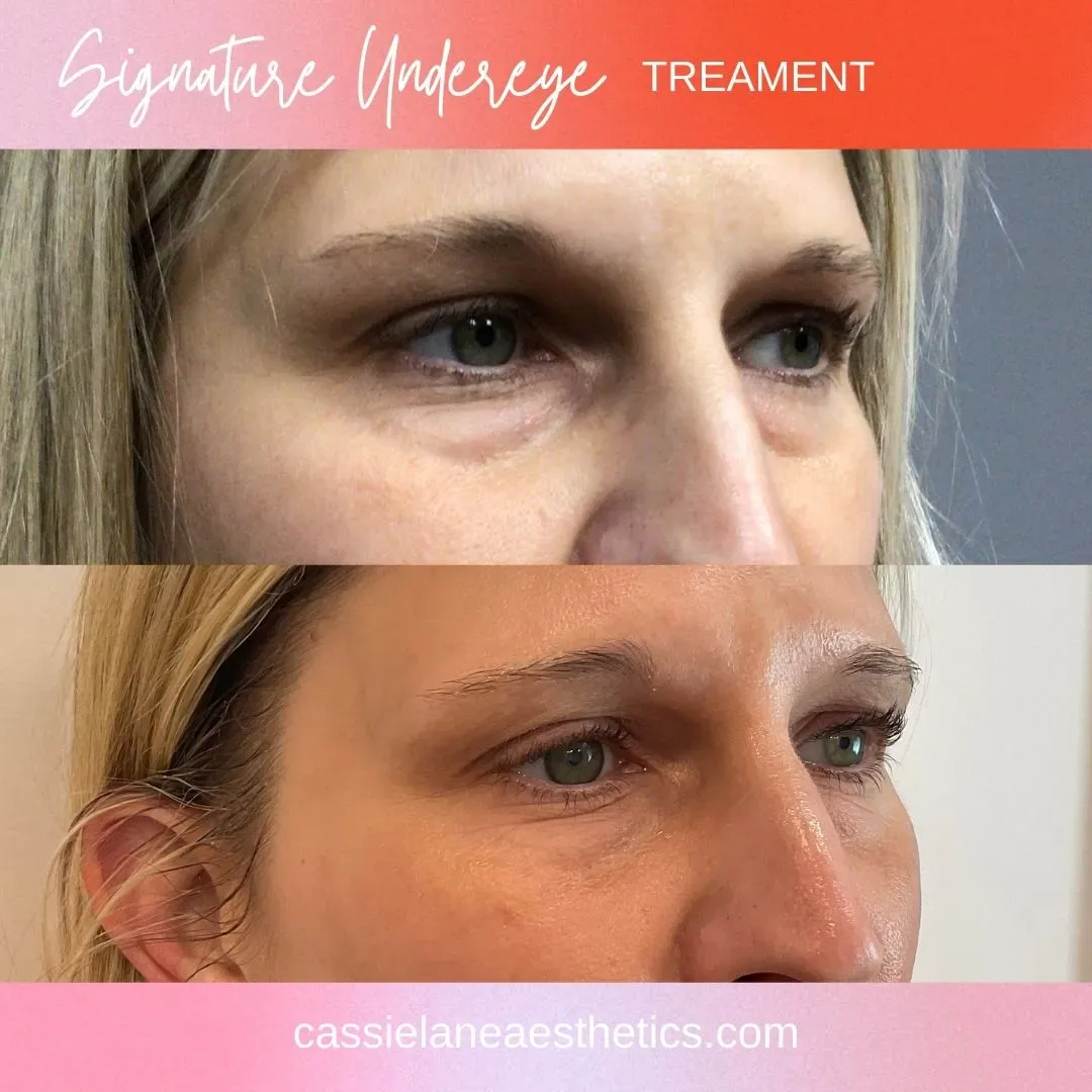 undereye website (2)_min