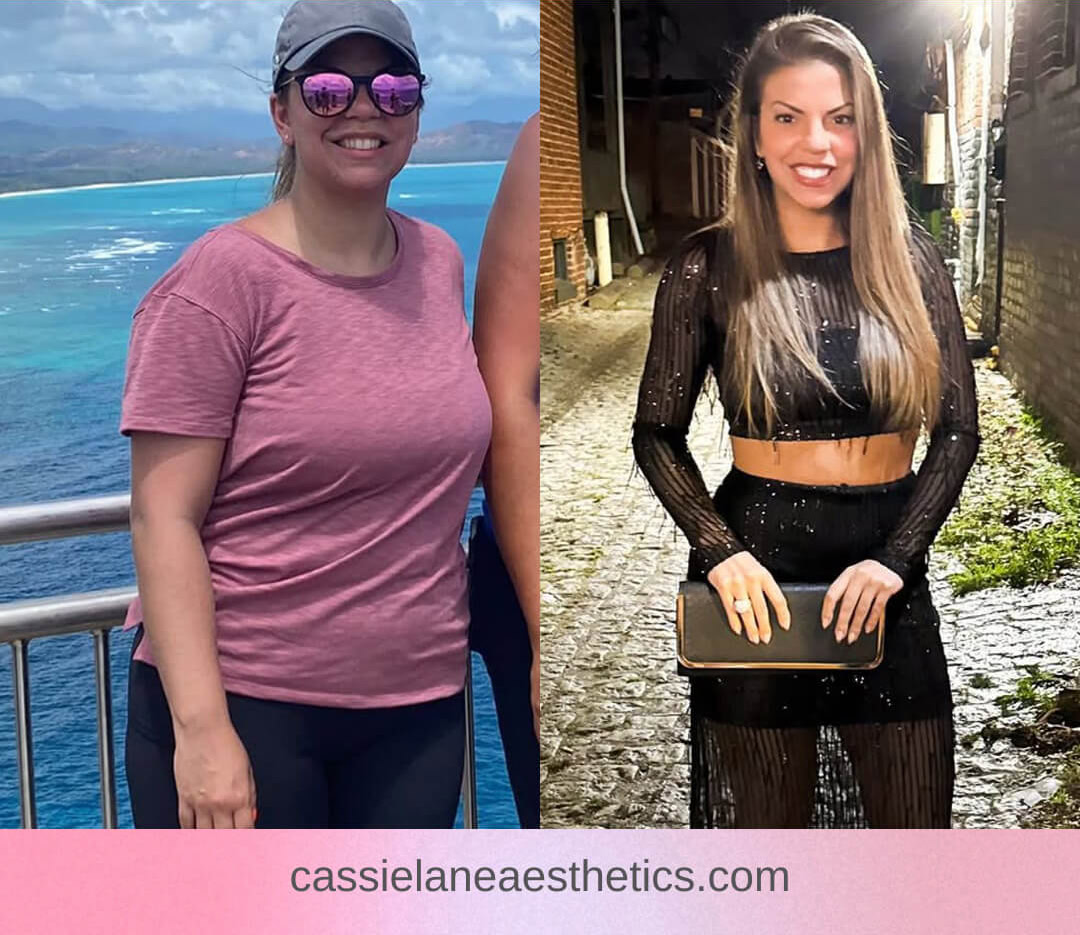 Medical Weight Loss Richmond VA