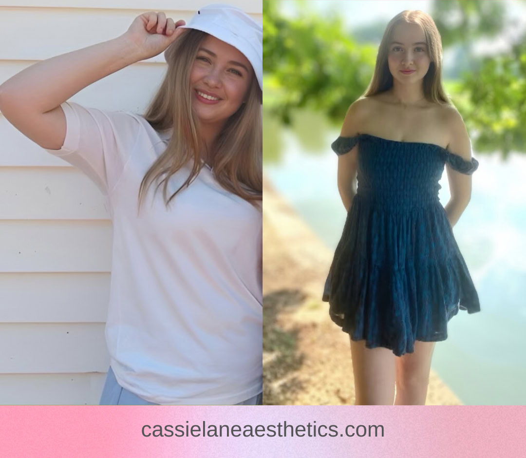 Medical Weight Loss Richmond VA