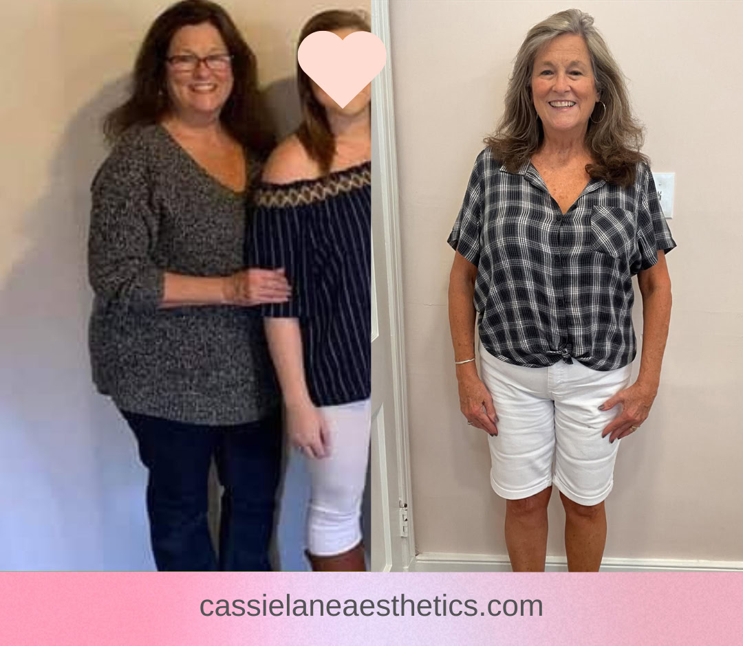 Medical Weight Loss Richmond VA