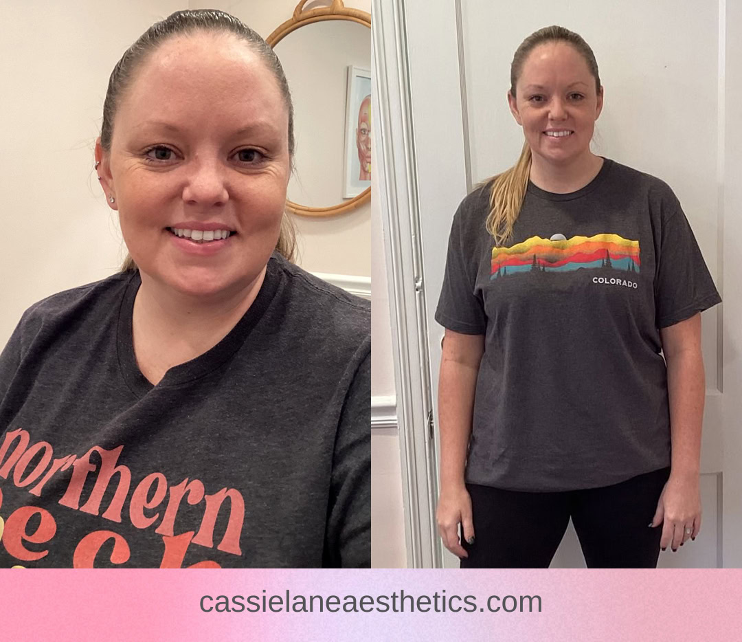 Medical Weight Loss Richmond VA