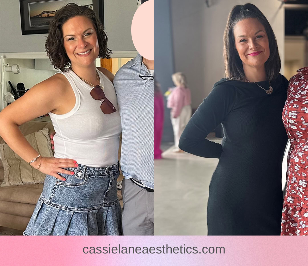 Medical Weight Loss Richmond VA